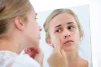 Acne Treatment