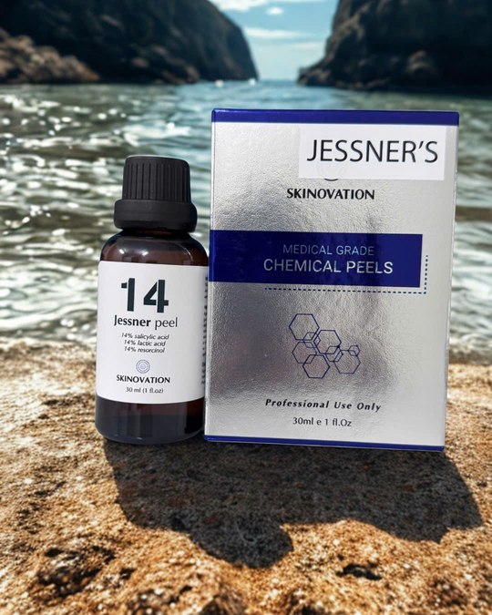 Jessner's Peel